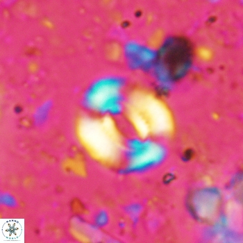 Watznaueria coronata 5239