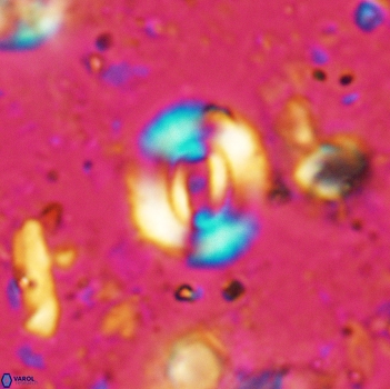Watznaueria coronata 5240