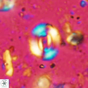 Watznaueria coronata 5240