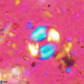 Watznaueria coronata 5243