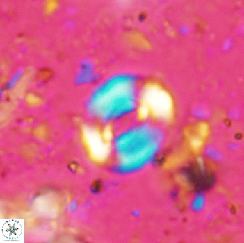 Watznaueria coronata 5243