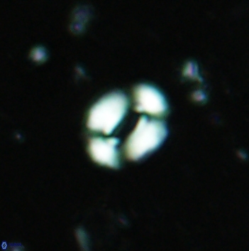 Watznaueria coronata 5844