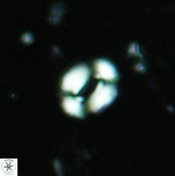 Watznaueria coronata 5844