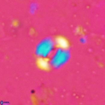 Watznaueria coronata 5845