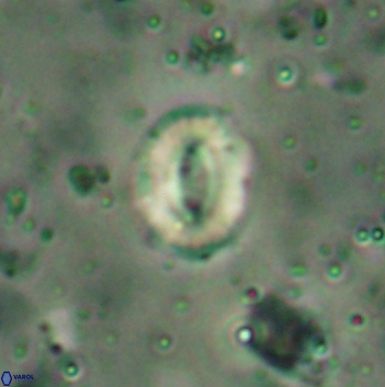 Watznaueria coronata 5846