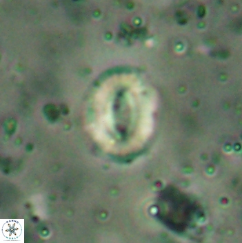 Watznaueria coronata 5846