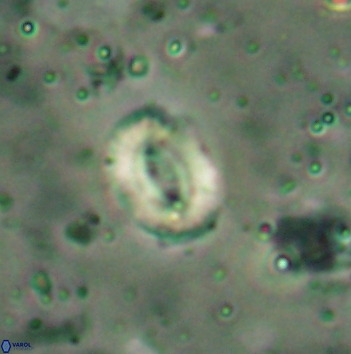 Watznaueria coronata 5847