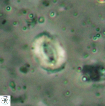 Watznaueria coronata 5847