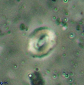 Watznaueria coronata 5848