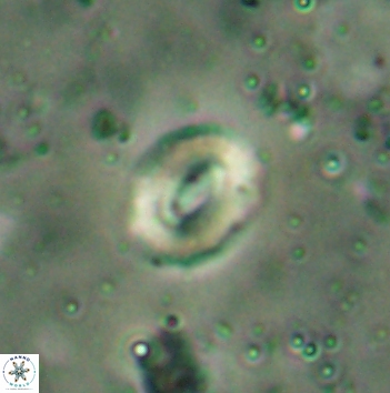 Watznaueria coronata 5848