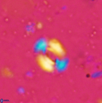 Watznaueria coronata 5841