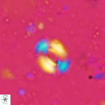 Watznaueria coronata 5841