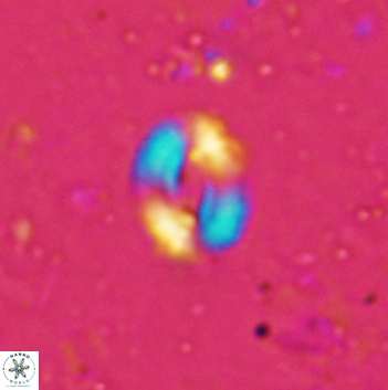 Watznaueria coronata 5842