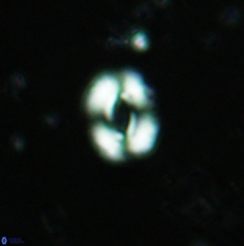 Watznaueria coronata 5843