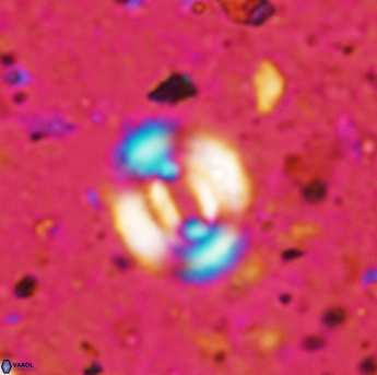 Watznaueria coronata 1574