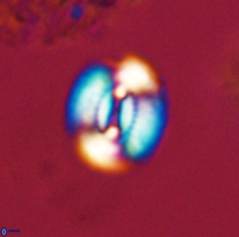 Watznaueria coronata 39866