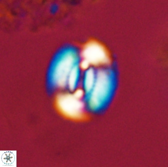 Watznaueria coronata 39866