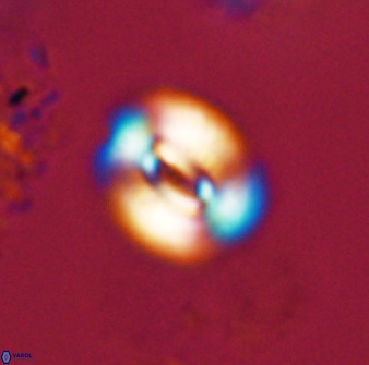 Watznaueria coronata 39867