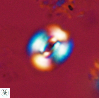 Watznaueria coronata 39870