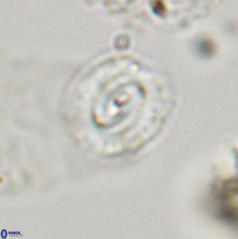 Watznaueria coronata 39872