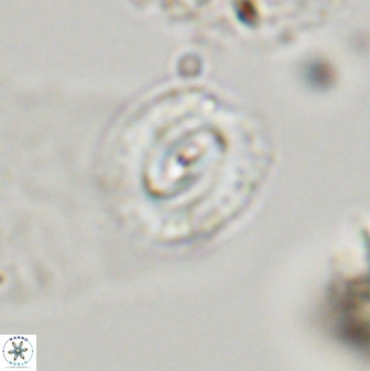 Watznaueria coronata 39872