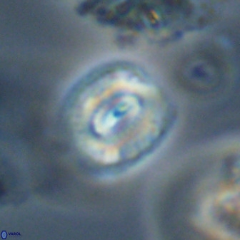 Watznaueria coronata 39874