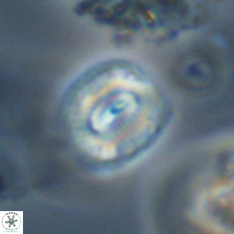 Watznaueria coronata 39874