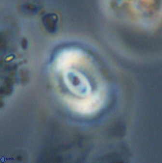 Watznaueria coronata 39875