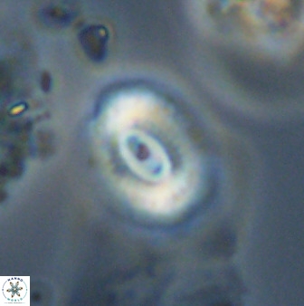 Watznaueria coronata 39875