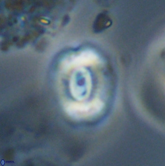 Watznaueria coronata 39876