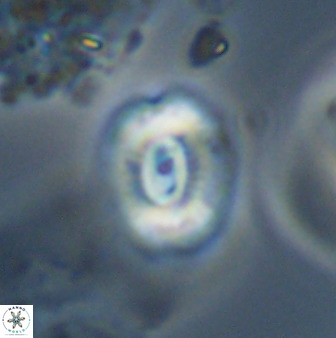 Watznaueria coronata 39876