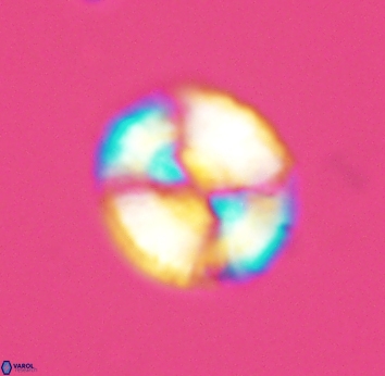 Watznaueria cynthae 2740