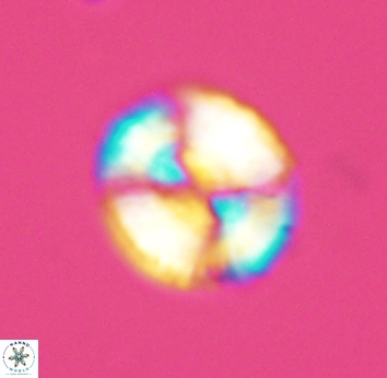 Watznaueria cynthae 2740