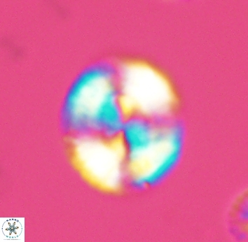 Watznaueria cynthae 2741