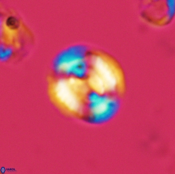 Watznaueria cynthae 3539