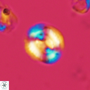 Watznaueria cynthae 3539