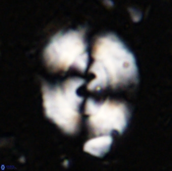Watznaueria cynthae 36398