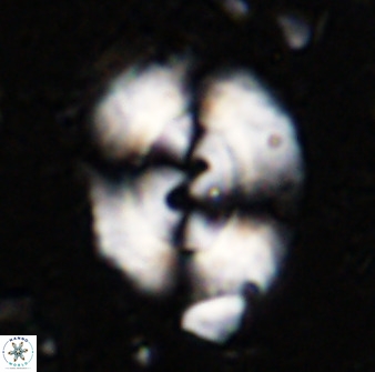 Watznaueria cynthae 36398