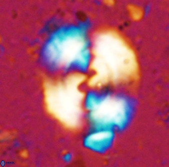 Watznaueria cynthae 36399