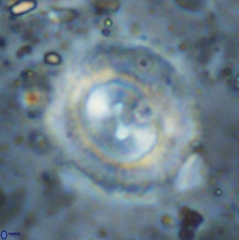 Watznaueria cynthae 36407