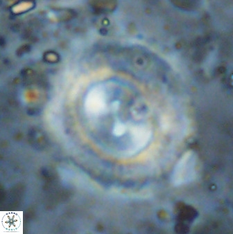 Watznaueria cynthae 36407