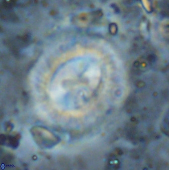 Watznaueria cynthae 36408
