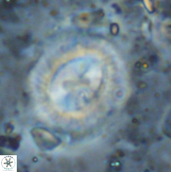 Watznaueria cynthae 36408