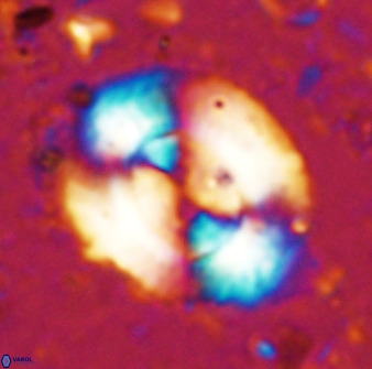 Watznaueria cynthae 36400