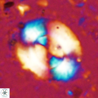 Watznaueria cynthae 36400