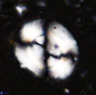 Watznaueria cynthae 36401