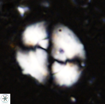 Watznaueria cynthae 36401