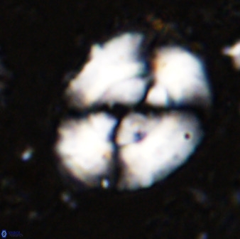 Watznaueria cynthae 36402