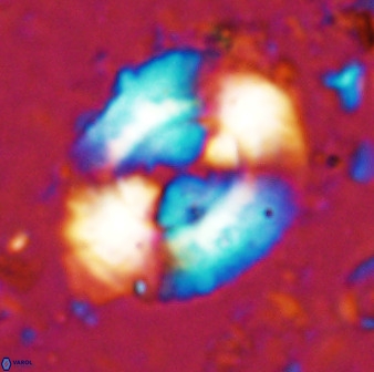 Watznaueria cynthae 36403
