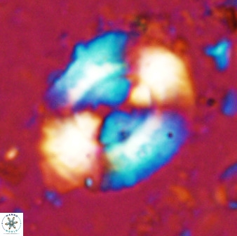 Watznaueria cynthae 36403